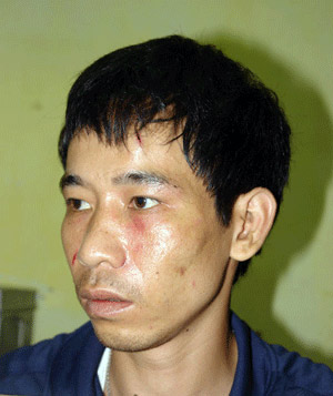 Dùng cảnh ''mặn nồng'' tống tiền tình nhân 50 triệu 